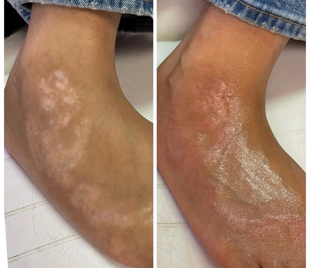 Paramedical permanent makeup by Erica Castaneda